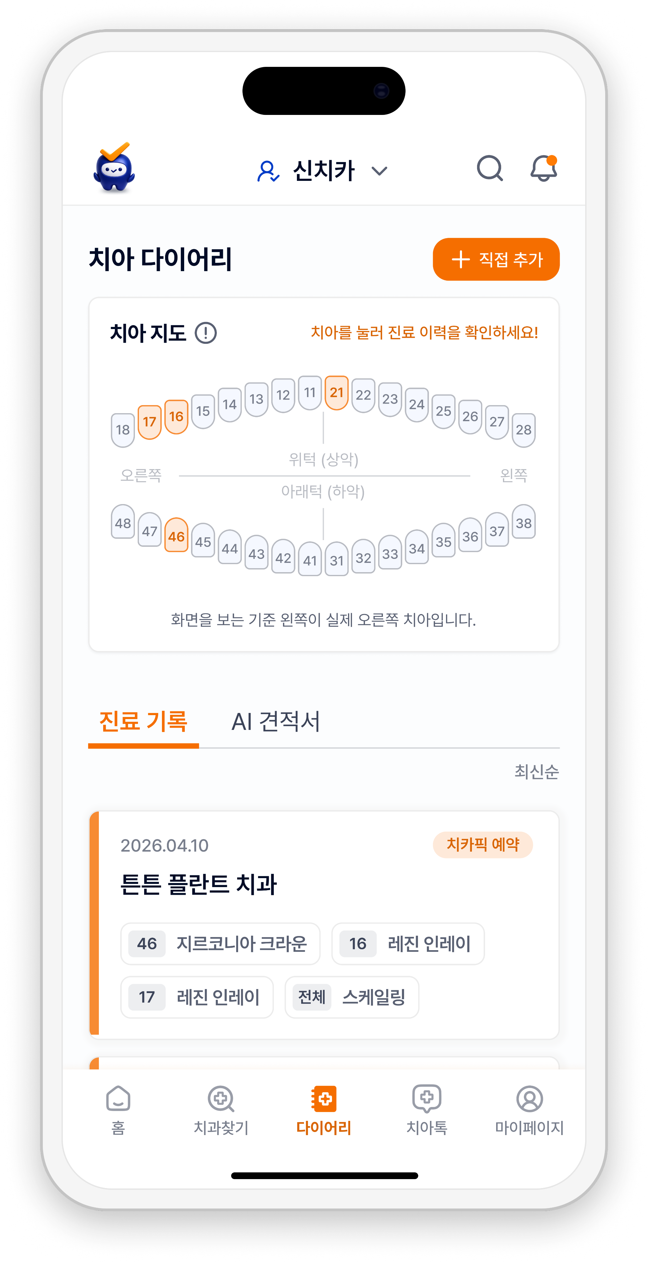 치아 지도와 진료 기록을 모아 보는 치아 다이어리 화면 예시